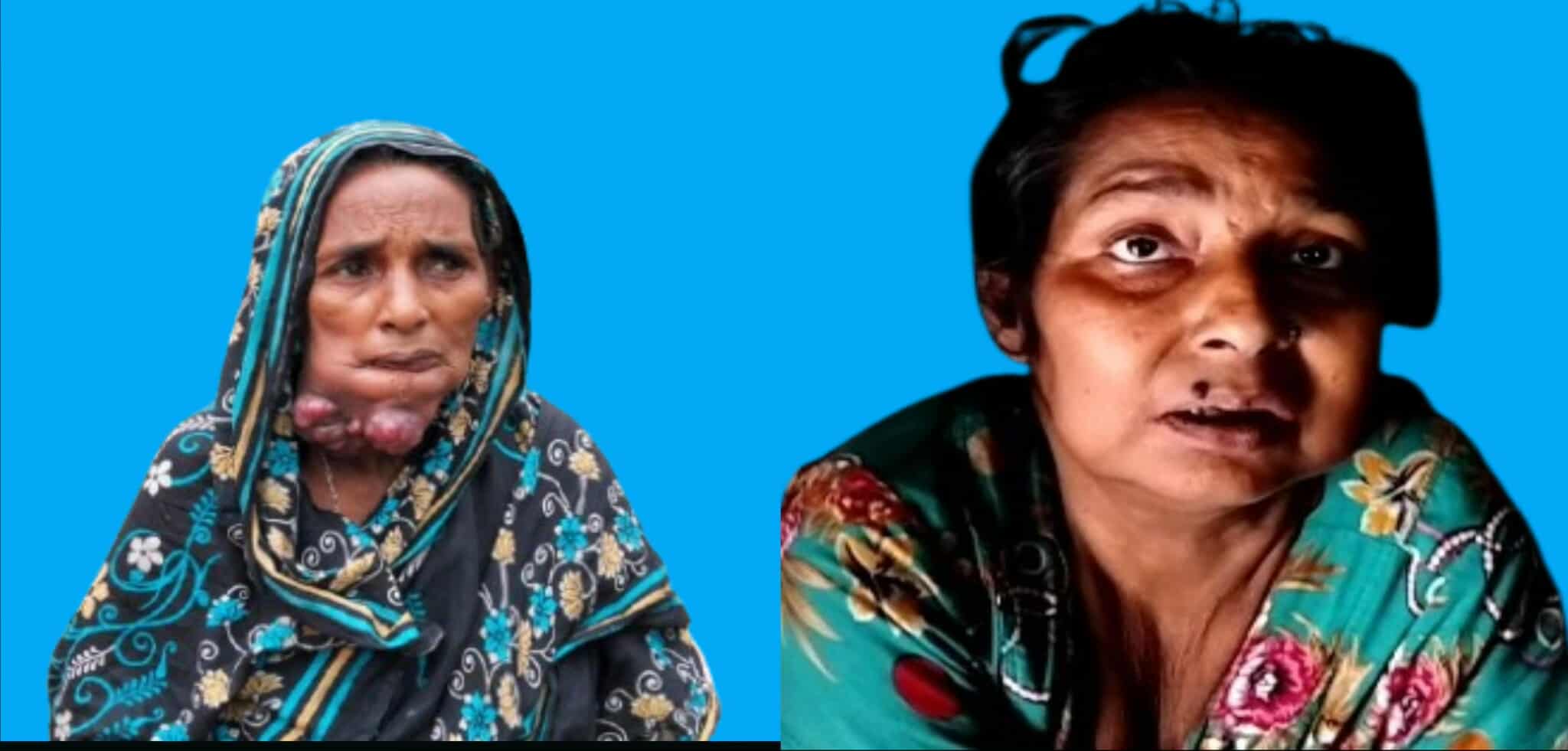 সুনামগঞ্জের মধ্যনগরে মা–মেয়ে গুরুতর অসুস্থ, ভাঙা কুঁড়েঘরে কষ্টের জীবন