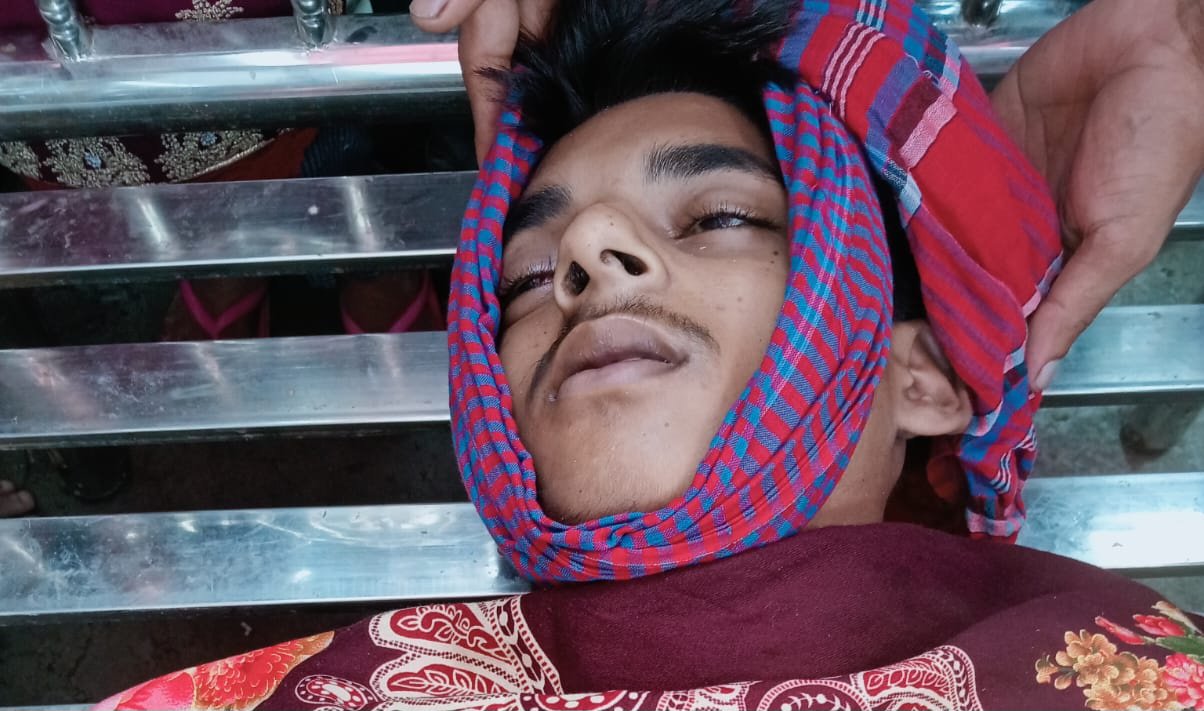 বজ্রপাতে মোঃ শাকিল আকন (১৭) নামে এক যুবকের মর্মান্তিক মৃত্যু