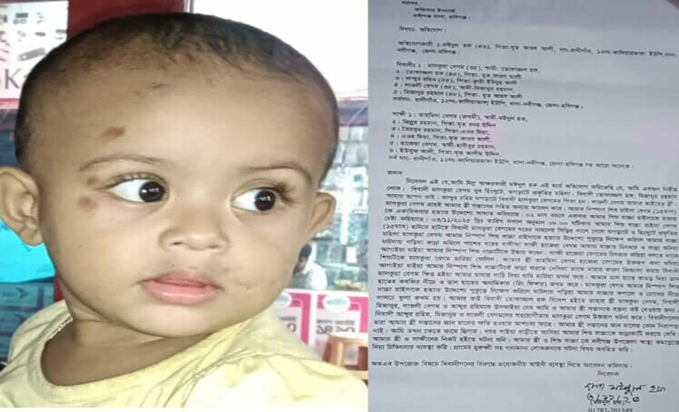 নবীগঞ্জে বড় ভাবীর হামলায় মা-বাবা ও ১৫ মাসের শিশুসহ দগ্ধ, থানায় লিখিত অভিযোগ