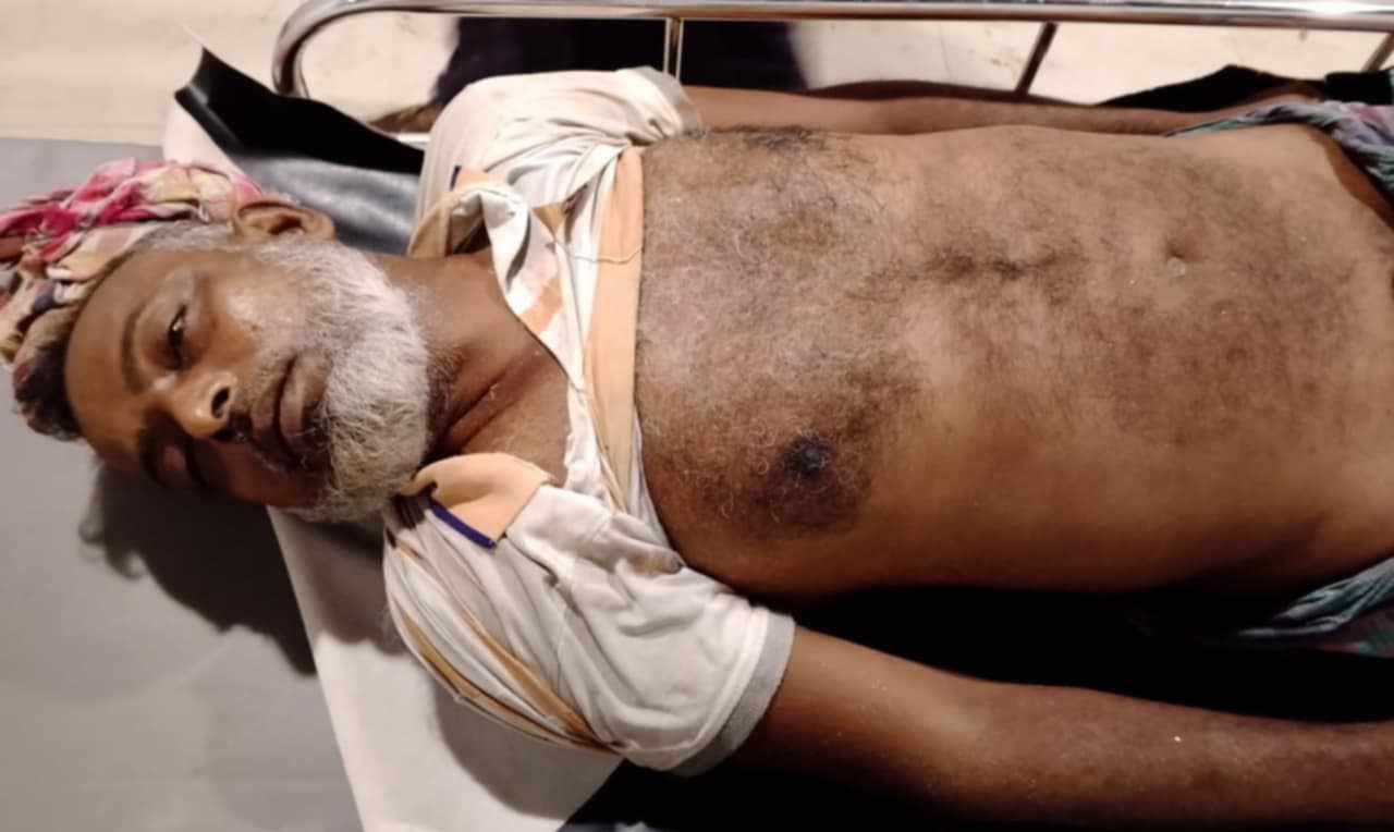 আশুলিয়ায় বজ্রপাতে এক নির্মাণ শ্রমিককে মৃত্যু